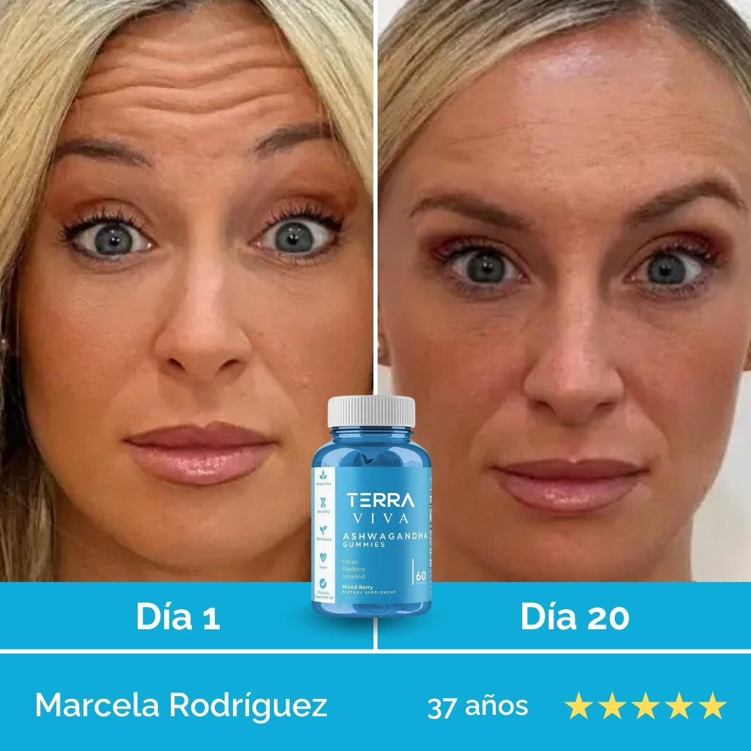 Elimina el estrés desde la raíz y transforma tu mente y tu piel con GummiFit® en 7 días