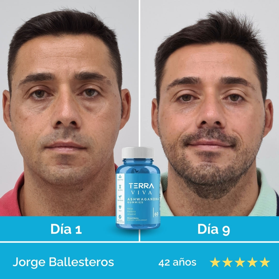 Elimina el estrés desde la raíz y transforma tu mente y tu piel con GummiFit® en 7 días