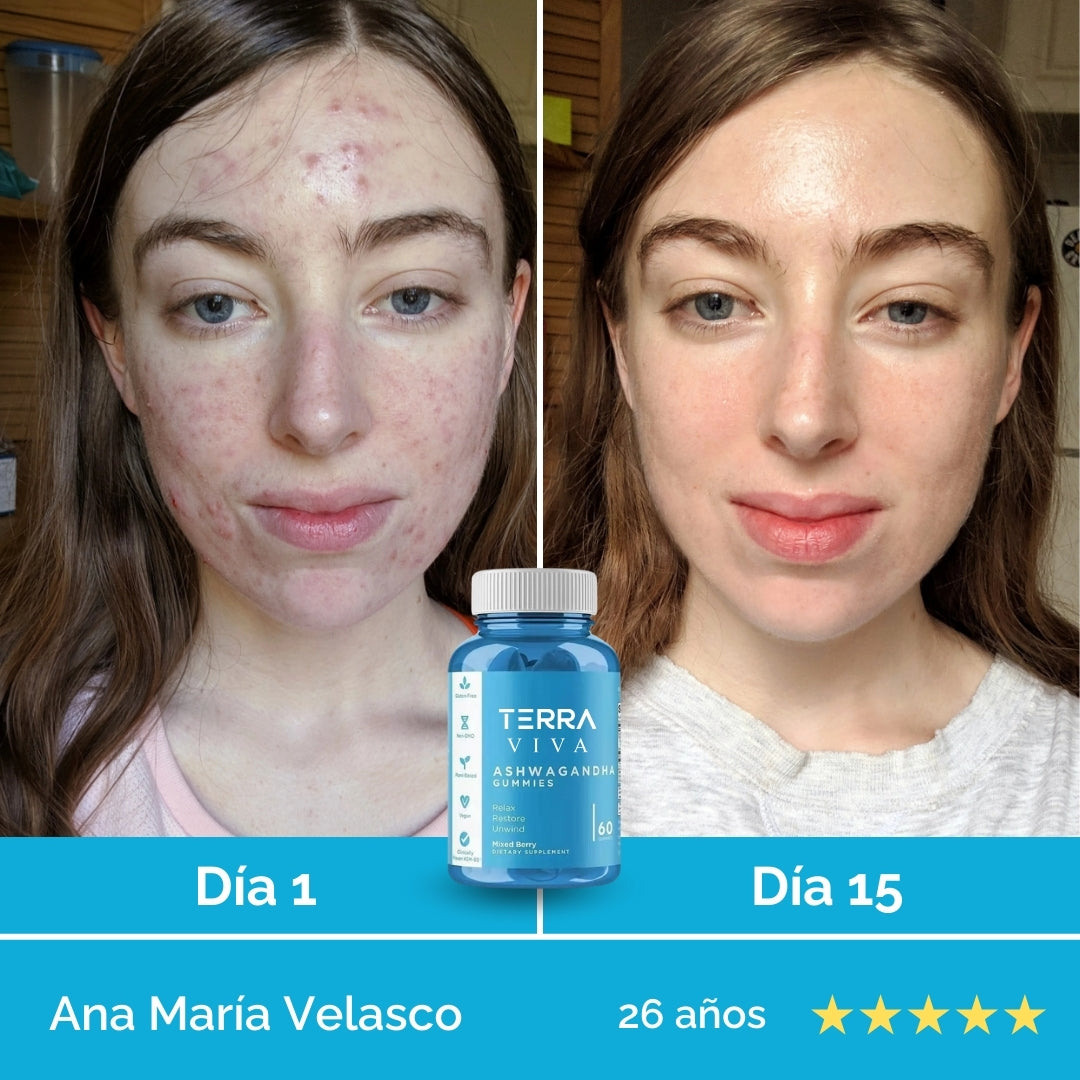 Elimina el estrés desde la raíz y transforma tu mente y tu piel con GummiFit® en 7 días