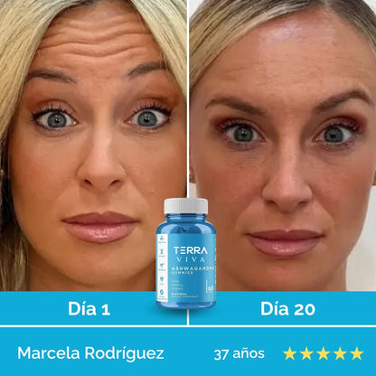 Elimina el estrés desde la raíz y transforma tu mente y tu piel con GummiFit® en 7 días