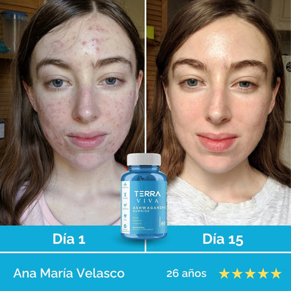 Elimina el estrés desde la raíz y transforma tu mente y tu piel con GummiFit® en 7 días